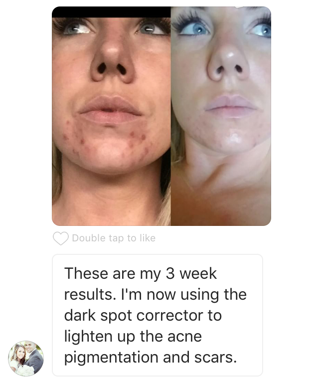 navan skin care trueclear reviews